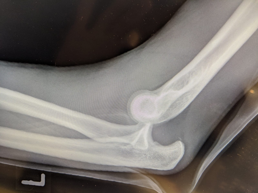 Wendrichs Röntgenbild. Wendrichs Röntgenbild.